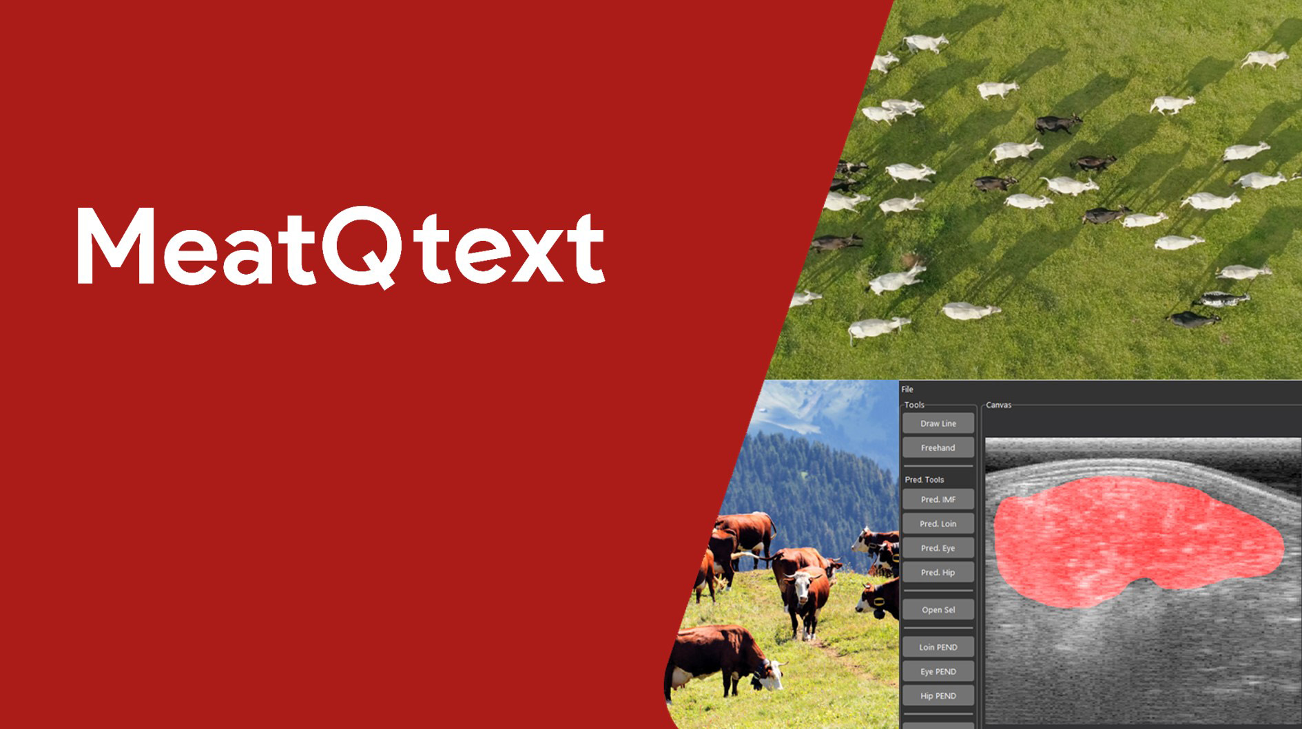 MeatQtext B超软件